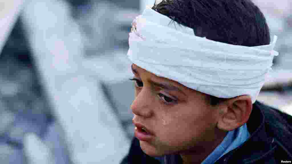 Egy palesztin kisfiú, aki megsebesült egy lakóházra mért izraeli csapásban a Gázai övezet déli részén fekvő Rafahban 2024. január 18-án. &bdquo;A csapatok először az al-Kair kórházat rohamozták meg, és letartóztatták az egészségügyi személyzetet&rdquo;&nbsp;&ndash; mondta el a Reutersnek Asraf al-Kidra, a gázai egészségügyi minisztérium szóvivője &nbsp;