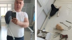 Вадим Шарипов и его "бионический" протез