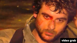 Eyewitnesses, including three injured men, told RFE/RL that what they called "provocateurs" arrived by car around 1 a.m. and physically assaulted some of the protesters. This image is from Georgia's 1TV channel.