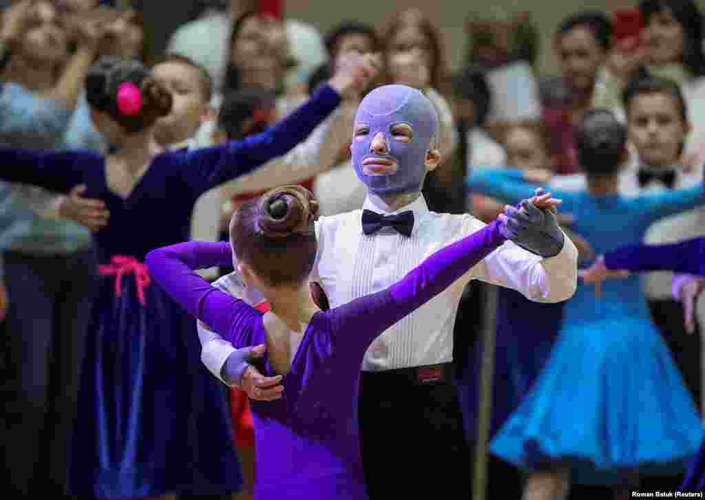 Roman, 8, wounded by a Russian missile strike last year, performs in a ballroom dance competition in Lviv with his face covered by a burn mask, after a year of skin grafts and over 30 surgeries.