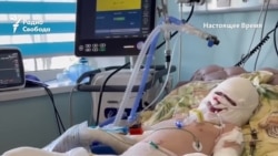 "Ожоги около 40% тела"