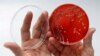 Literatura medicală vorbește tot mai apăsat despre riscul pe care rezistența bacteriilor la antibiotice îl reprezintă pentru sănătatea publică.