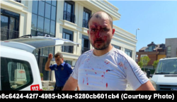 An activist who was beaten while trying to hand over a letter to President Serdar Berdymukhammedov at Turkmenistan's consulate in Istanbul in August last year.