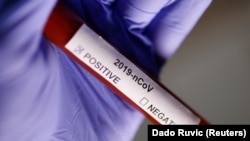 Un test de coronavirus