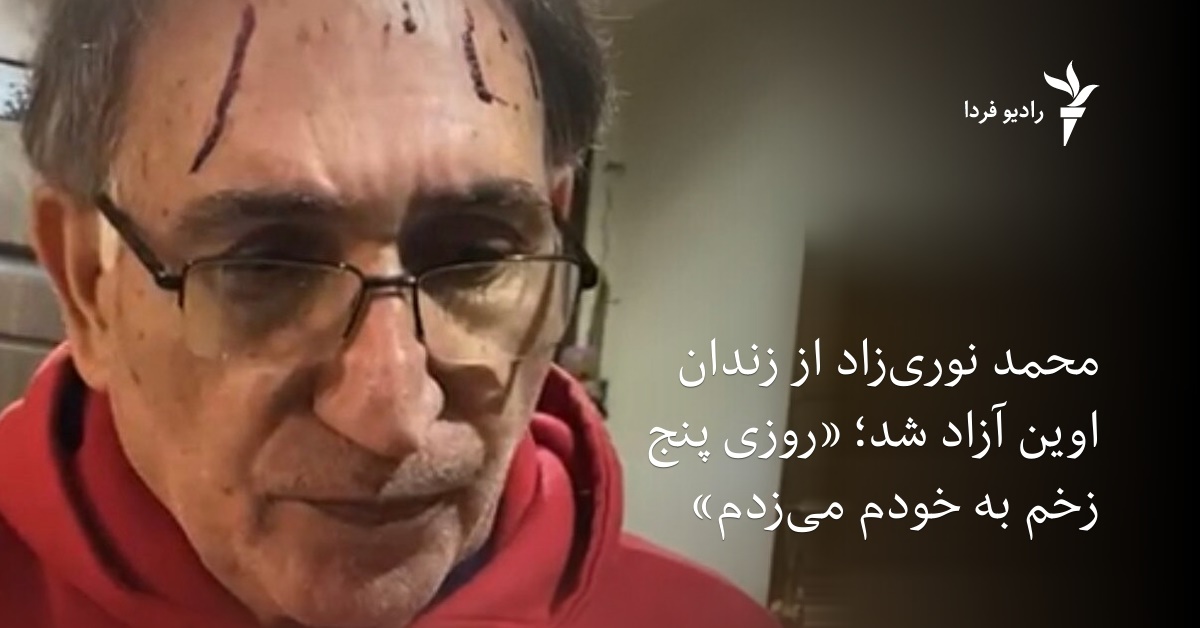 محمد نوری‌زاد از زندان اوین آزاد شد؛ «روزی پنج زخم به خودم می‌زدم