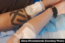 У шпіталі Алена і Сяргей правялі няшмат часу. Аднак пасьля Сяргею прыйшлося зноў туды вярнуцца