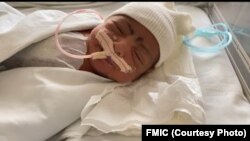 یکی از دو نوزاد به هم چسپیده پس از عملیات جراحی در شفاخانه فرانسوی در کابل.