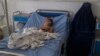 Aprelin 21-də Künduzda törədilmiş partlayışda yaralanmış uşaq