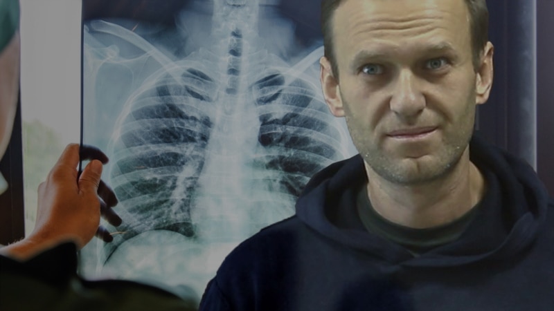 Навални: Цимерите во затворот заболуваат од туберколоза