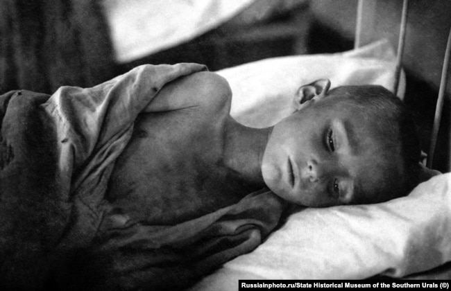 Истощенный ребенок. Челябинская область, 1921 год