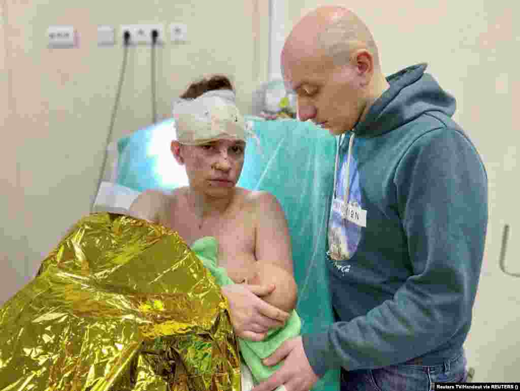 A Ukrainian woman, who was seriously wounded while sheltering her baby from shrapnel blasts amid Russia&#39;s ongoing invasion of Ukraine, holds her baby as her husband stands by her side in Kyiv.