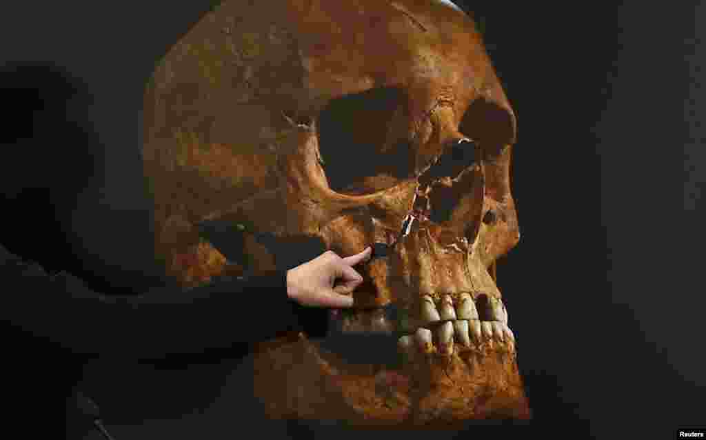 The skeleton was found to have a curved spine and signs of severe battle injuries, matching historical descriptions of King Richard III, the last British king to die in battle.