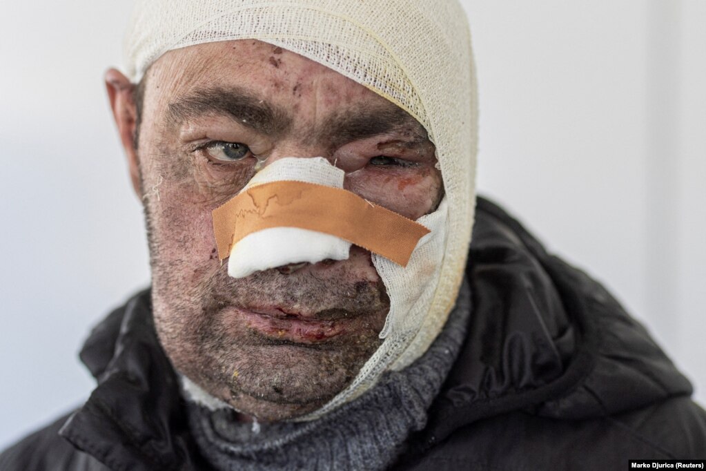 Victor, një burrë i plagosur, i cili ka thënë se është lënduar nga një granatim, duke qëndruar para një spitali. (Brovari, 19 mars)