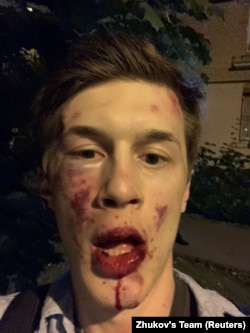 Yegor Zhukov poses for a picture after he was assaulted by unknown people near his apartment in Moscow on August 30.