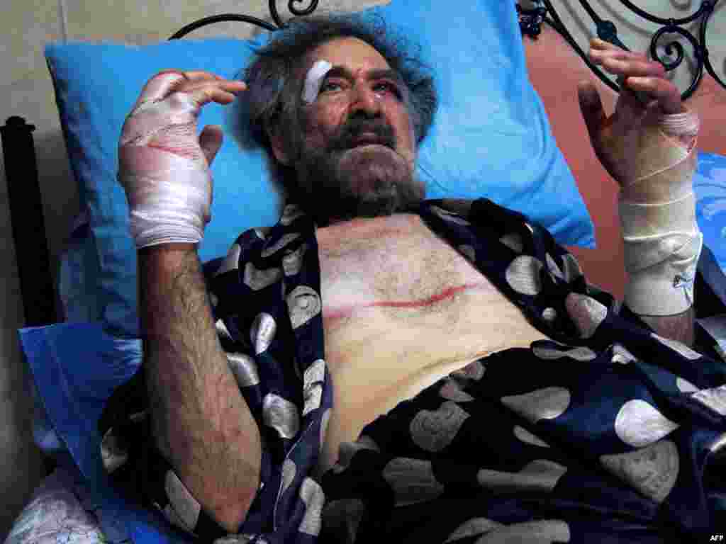 Wounded cartoonist Ali Ferzat rests in bed at his residence in Damascus after being grabbed and beaten up by pro-regime militiamen.