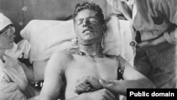 Английский солдат в госпитале после газовой атаки под Ипром. 1915 г.