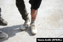 Migrant Naquibullah iz Avghanistana pokazuje povrede koje je dobio, kako kaže, zbog dugog pešačenja na migrantskom putu.