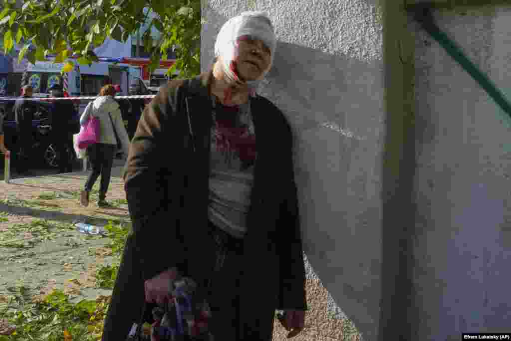 An injured woman at the scene of a missile strike in central Kyiv.