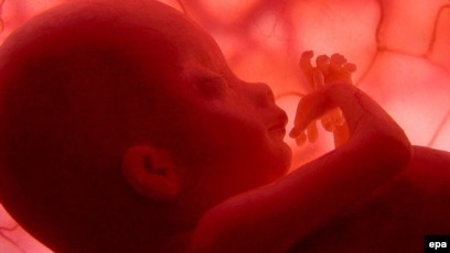 Актрисаның есімдері жалаңаш және күлкілі