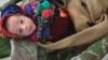آرشیف - یک کودک مصاب به سوء تغذیه در ولایت بادغیس
