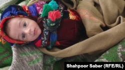 آرشیف - یک کودک مصاب به سوء تغذیه در ولایت بادغیس