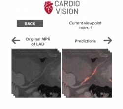 Із проекту Марії Добко Cardio Vision