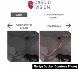 Із проекту Марії Добко Cardio Vision