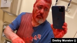 A photo of Muratov posted by the newspaper on Telegram showed his head, shirt, hands, and arms covered in red paint.