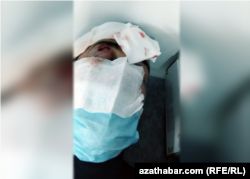 Азиз Мамедов получил повреждения глаз и перелом носа