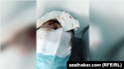 В Стамбуле жестоко избит Азиз Мамедов