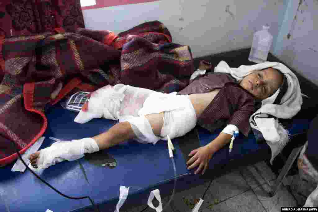 Раненый йеменский ребенок на носилках в госпитале в Таизе, 30 октября. По данным ЮНИСЕФ, в Йемене развернулся крупнейший гуманитарный кризис, около 21 миллиона человек нуждаются в помощи, в том числе более 11 миллионов детей&nbsp;
