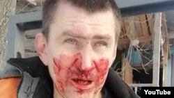 Sergei Sherementyev said he was assaulted by three individuals who were transported to the site by ex-lawmaker Pyotr Fink.