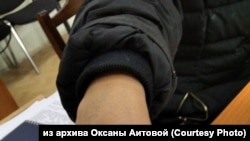 Следы от наручников на руке Оксаны Аитовой