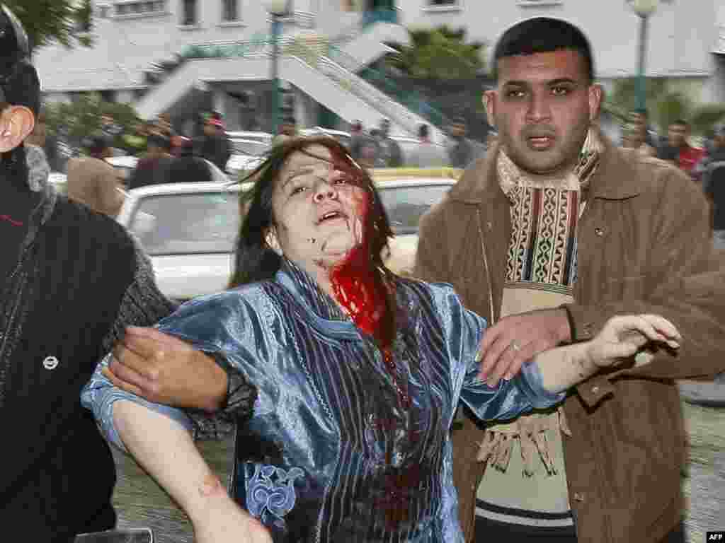 Палестинцы сопровождают раненную женщину в госпиталь, после атаки ВВС Израиля, 27 декабря 2008.