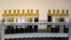 Пробирки с кровью для анализа на ВИЧ, гепатит и сифилис