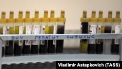 Пробирки с кровью для анализа на ВИЧ, гепатит и сифилис