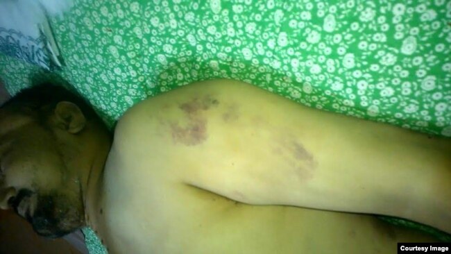 Марҳум Ибодов баданида қийноқ изларини кўриш мумкин