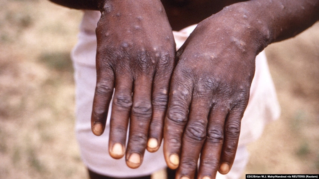 Автобуста жыныстық қатынасқа қараңыз