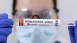 Illustration shows test tubes labelled "Monkeypox virus positive\