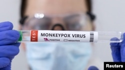 Epruvetë e shenjuar me rezultat pozitiv në testimin e virusit të lisë së majmunëve. Fotografi ilustruese.