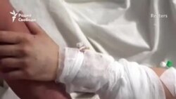 "Много было людей обгоревших, оборванных, в крови"