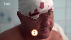 Украинага босқин: 125- кун | Кременчугдаги портлашда 20 киши ўлди
