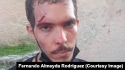 Fernando Almejda Rodriguez zadobio je povredu glave za vreme protesta 11. jula 2021.