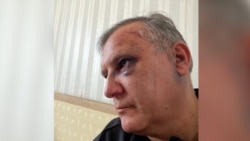 Bound, Beaten, And Bruised: Ukrainian Villager Recounts Torture By Russian Troops