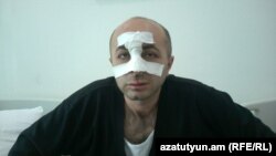 Нагорный Карабах -- Оппозиционный Айк Ханумян после избиения в больнице Степанакерта, 7 июня 2016 г.
