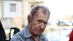 Un bărbat rănit în așteptarea îngrijirilor medicale după bombardamentele ruse în orașul Ciuguiv din estul Ucrainei, 24 februarie, 2022