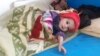 آرشیف - یک کودک مصاب به بیماری سوء تغذیه در ولایت غور