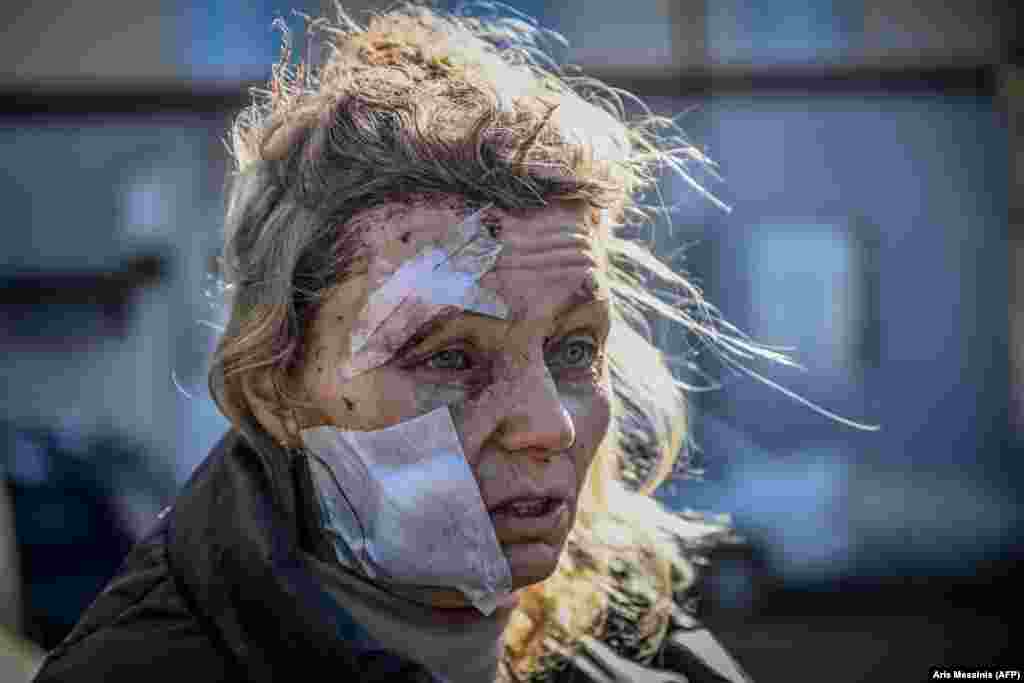 Параненая жанчына стаіць ля шпіталя пасля бамбавання гораду Чугуева на ўсходзе Ўкраіны. 24 лютага