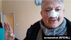 Anti-vax crusader Ventsislav Angelov (aka Chicago) after the violent incident at a doctor's office in the Bulgarian village of Novo Selo on January 17. 