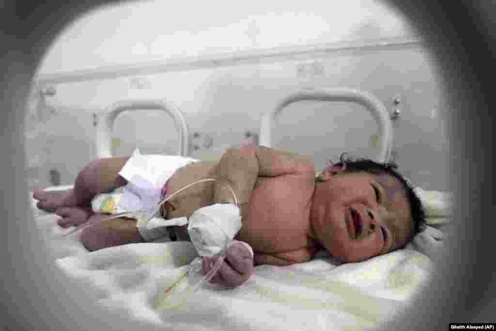 Во сирискиот град Африн, девојче кое се родило под урнатините на петкатна станбена зграда се лекува во детска болница. Локалните жители го откриле новороденчето откако го слушнале нејзиниот плач под урнатините.